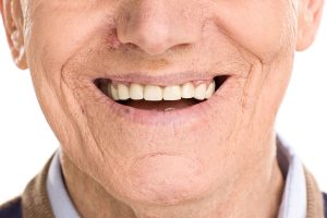 Osteoporose atinge cerca de 10 milhões de brasileiros
