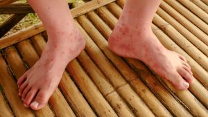 Máscara no Calor? Veja como evitar o desconforto!